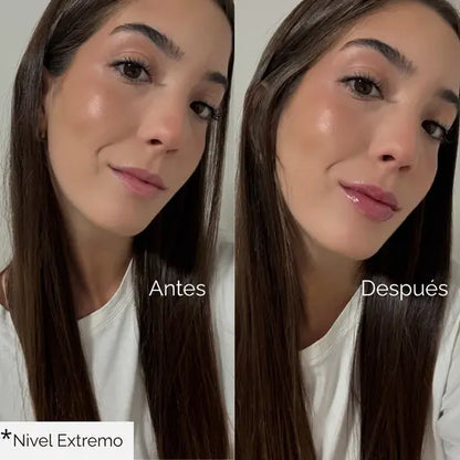 Voluminizador de Labios